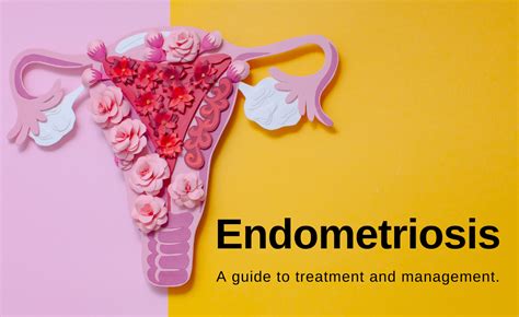 endometriosis private treatment cost uk