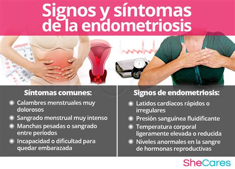 endometriosis signos y sintomas