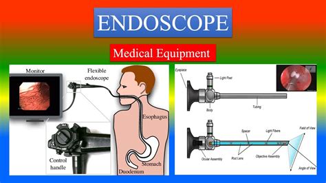 Endoscope Term Definition