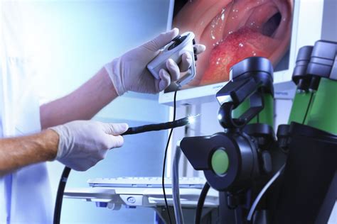 endoscopy and colonoscopy