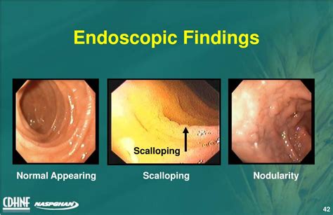 Endoscopy Findings