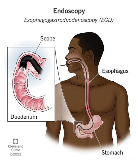 Endoscopy For Heart