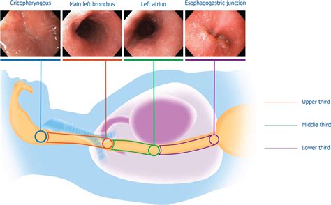 Endoscopy Normal Throat