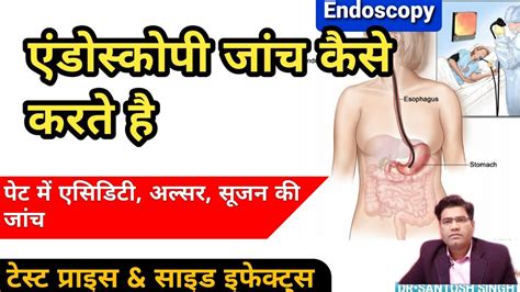 Endoscopy Test Information In Hindi