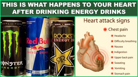 energy drinks side effects