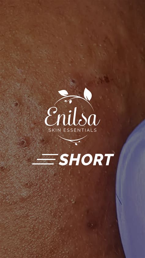 enilsa