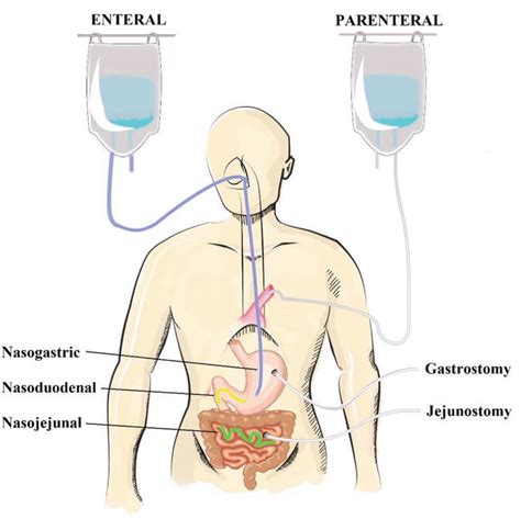 Enteral Feeding Define