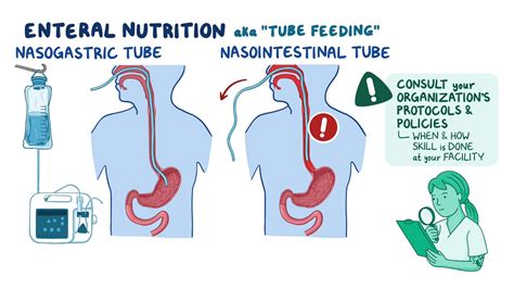 enteral nutrition near me