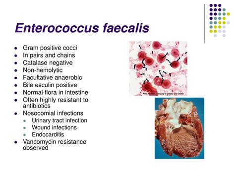 enterococcus faecalis bactrim coverage