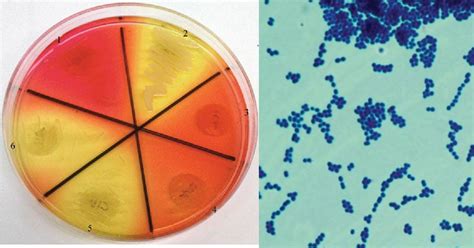 Enterococcus Faecalis Gelatin Hydrolysis Test