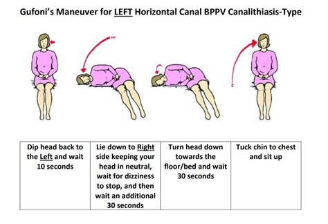 epley maneuver home instructions