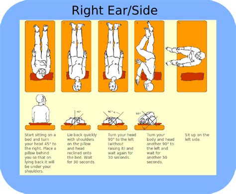 epley maneuver instructions for right ear