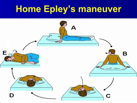 epley post procedure advice