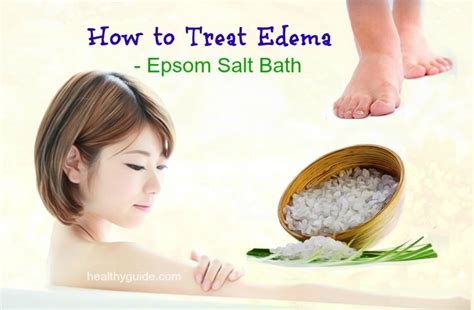 Epsom Salt Bath Edema