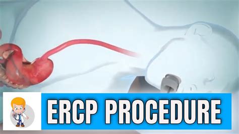 ercp with endoscopic ultrasound cpt code