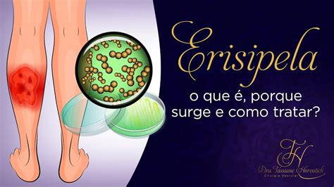 erisipela o que e