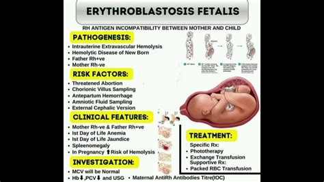 erythroblastosis fetalis treatment