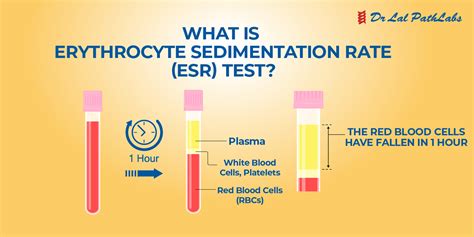 erythrocyte sediment