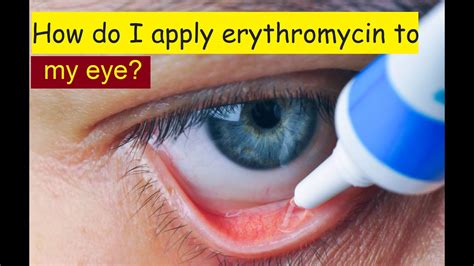 erythromycin eye ointment how to apply