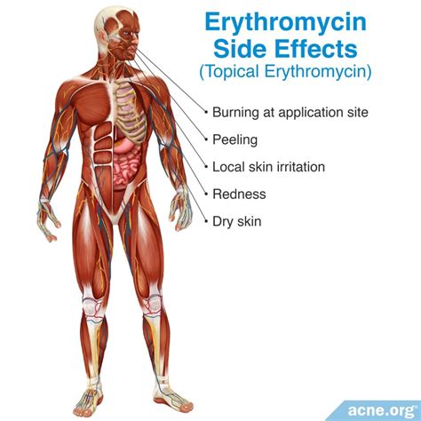Erythromycin Side Effects Printable