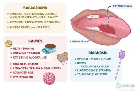 erythroplakia treatment