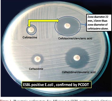 esbl e coli uptodate