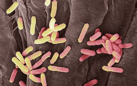 escherichia coli abnormal in urine