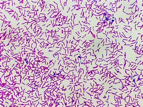 escherichia coli gram