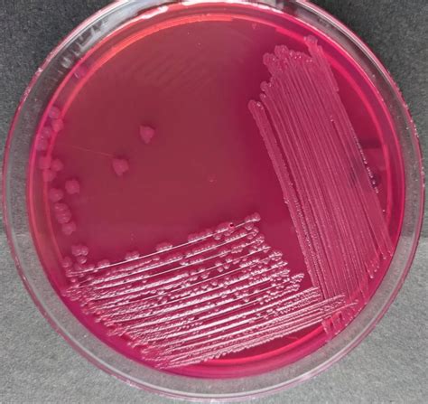 escherichia coli on macconkey agar
