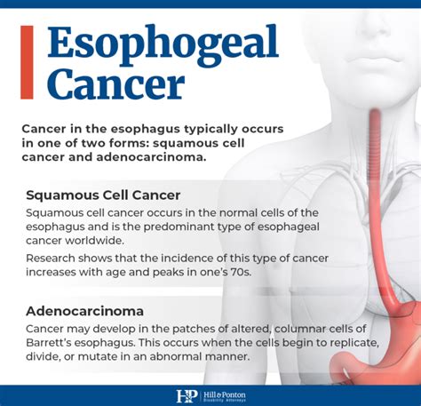 esophageal cancer ssa listing