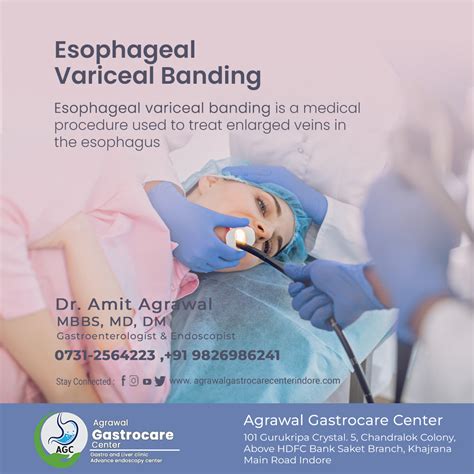 esophageal varices banding aftercare