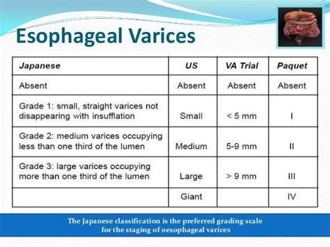 esophageal varices grade 2