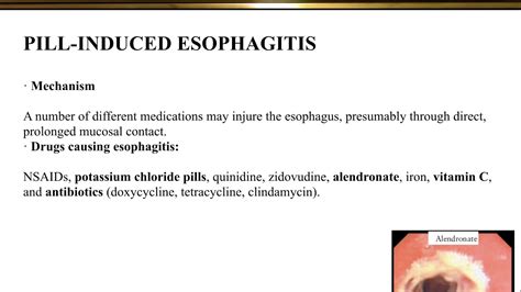 esophagitis medication induced