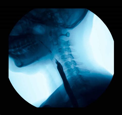 esophagram