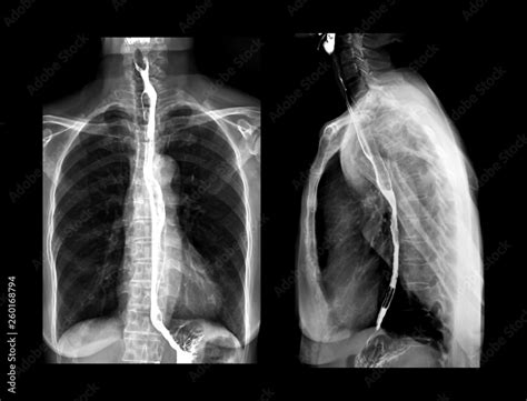 esophagram what is it