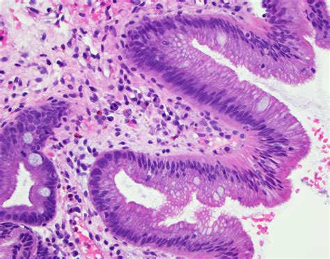 esophagus histology pathology outlines