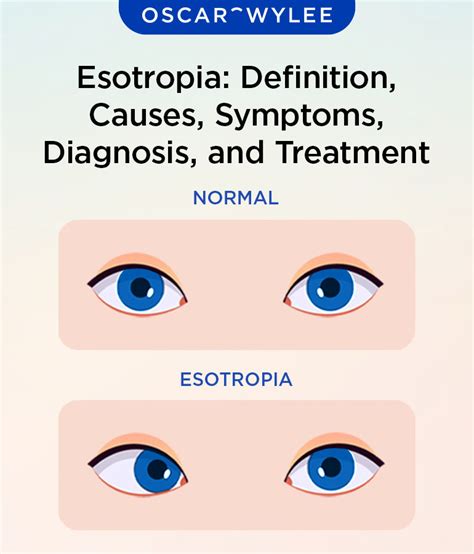 esotropia definition
