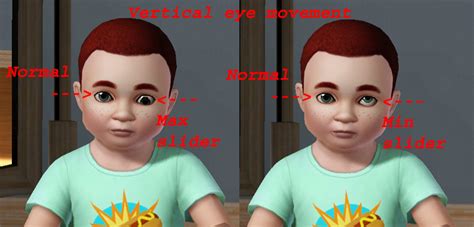 esotropia exotropia slider by obscurus-sims