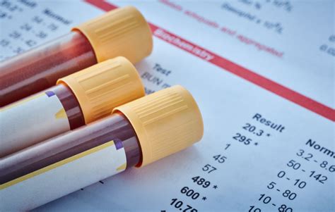 Esr Blood Test Crohn's Disease