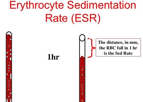 esr sed rate erythrocyte sedim...