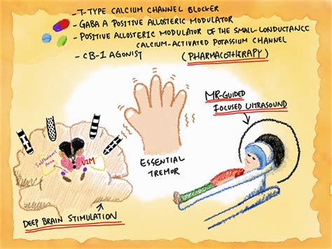 essential tremor nhs uk