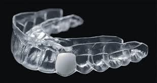 Essix Retainer With Tooth Cdt Code