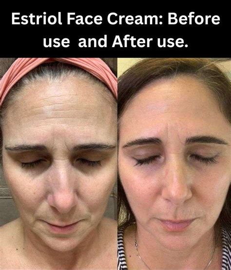 estriol face