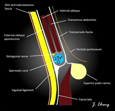 estruturas do canal inguinal