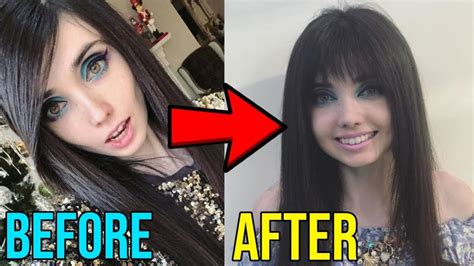 eugenia cooney before after