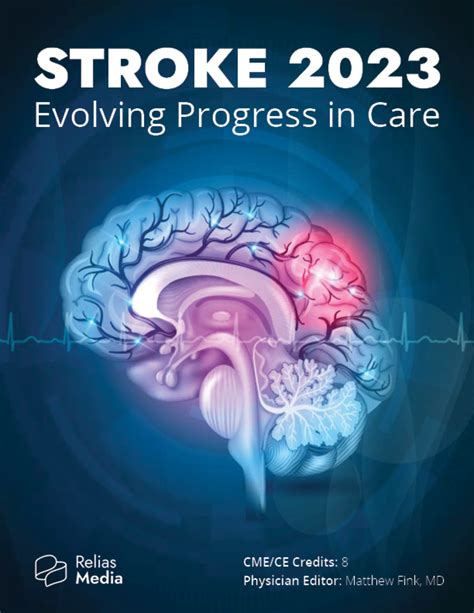 Evolving Practices in Stroke Care Image