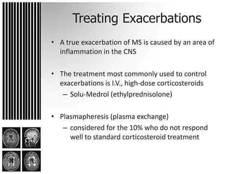 exacerbation of ms