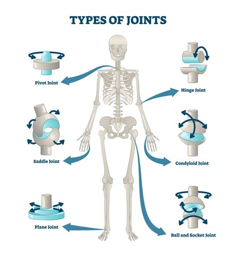 example of each type of joint