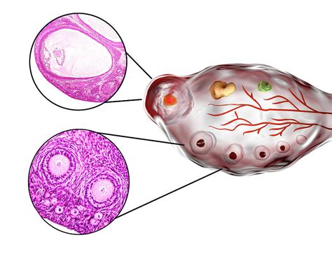 Example Of Ovarian Follicle