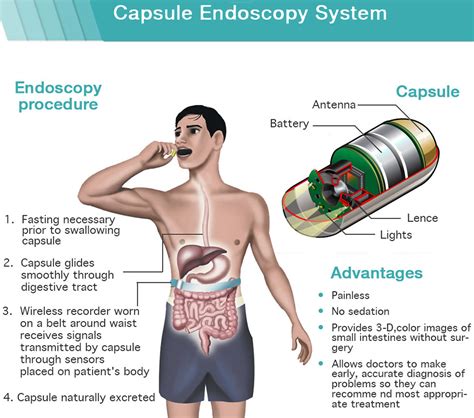 examples of endoscopic procedures